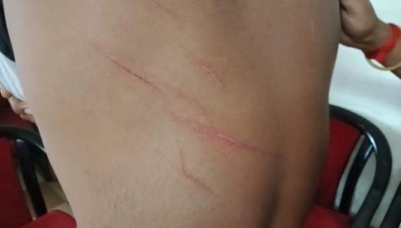 BJP Attacked on 2 TMC Members at Khowai, Khayerpur : TMC Party Convener alleged, ‘Jungle Raj’ under BJP BJP Attacked on 2 TMC Members at Khowai, Khayerpur : TMC Party Convener alleged, ‘Jungle Raj’ under BJP